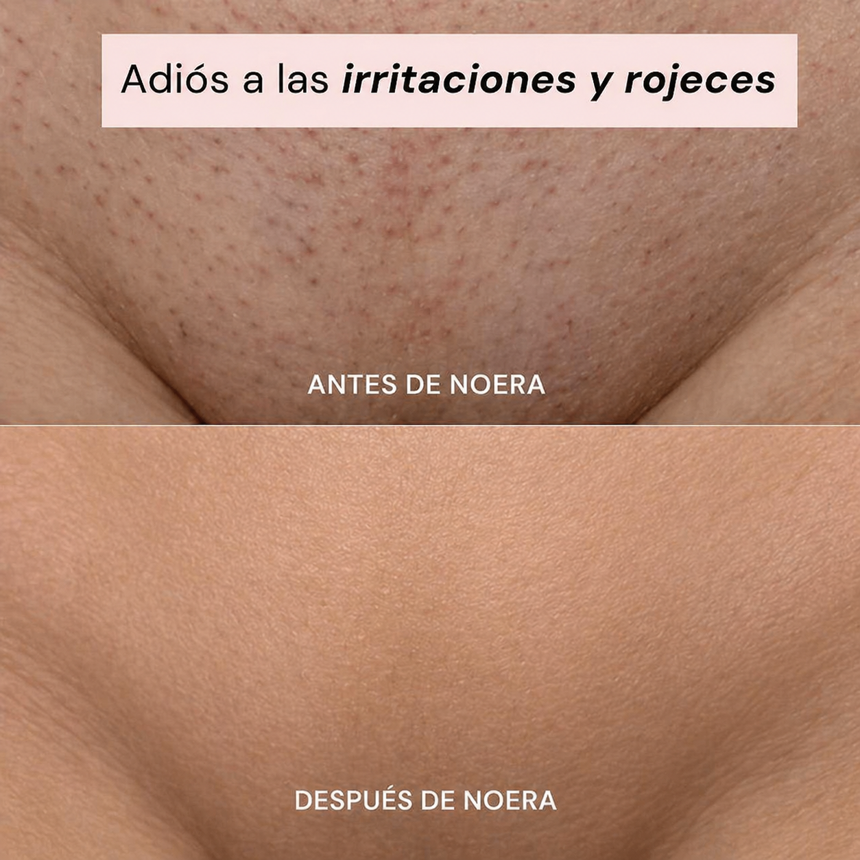 NOERA - Depiladora Íntima 2 en 1