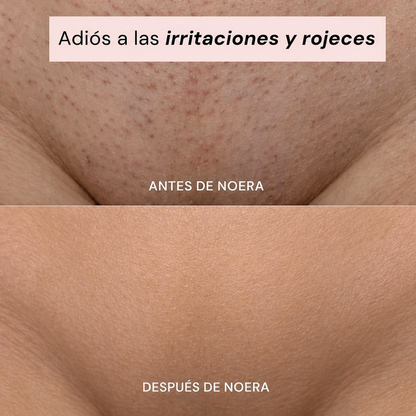 NOERA - Depiladora Íntima 2 en 1